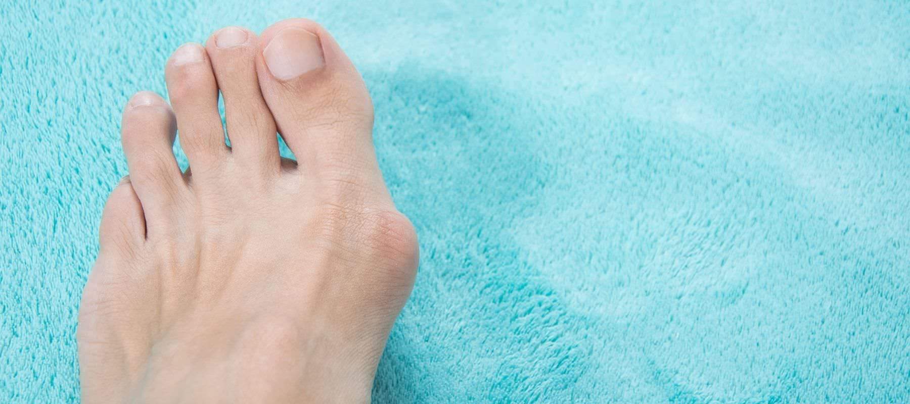 Silicone & Foot Care Bunions Metatarsals Heels Toes - Tynor Australia