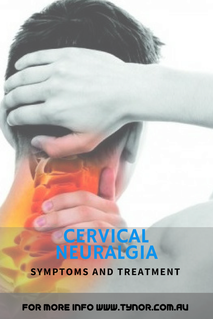 Cervical neuralgia Symptoms and treatment