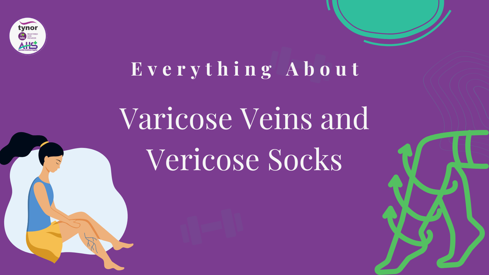 varicose veins treatment 