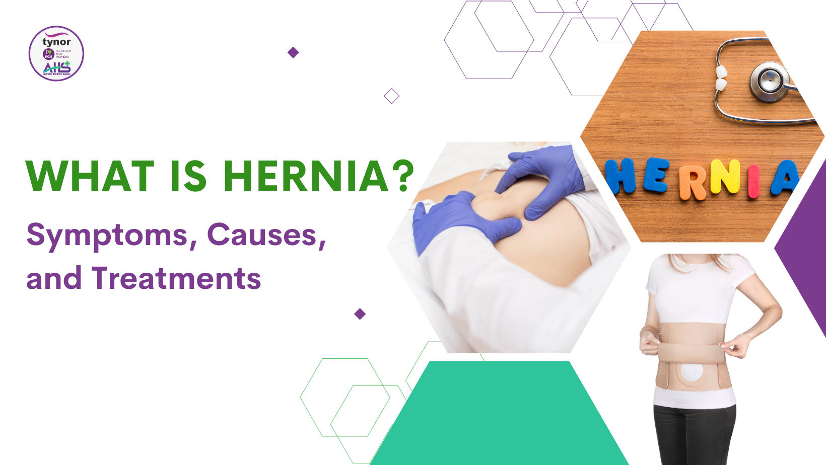 What is Hernia? Symptoms, Causes, and Treatments