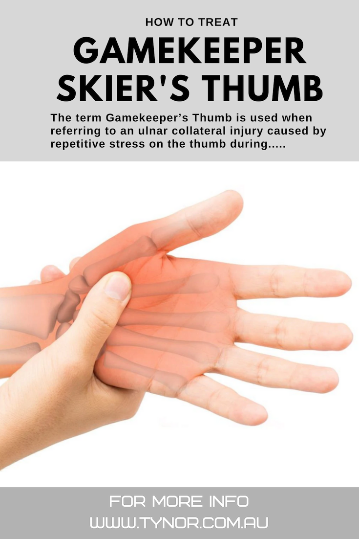 How to Treat Gamekeepers or Skier's Thumb