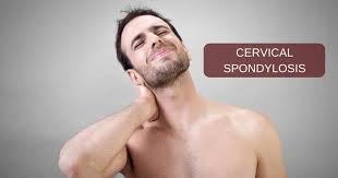 What is Cervical Spondylosis ?