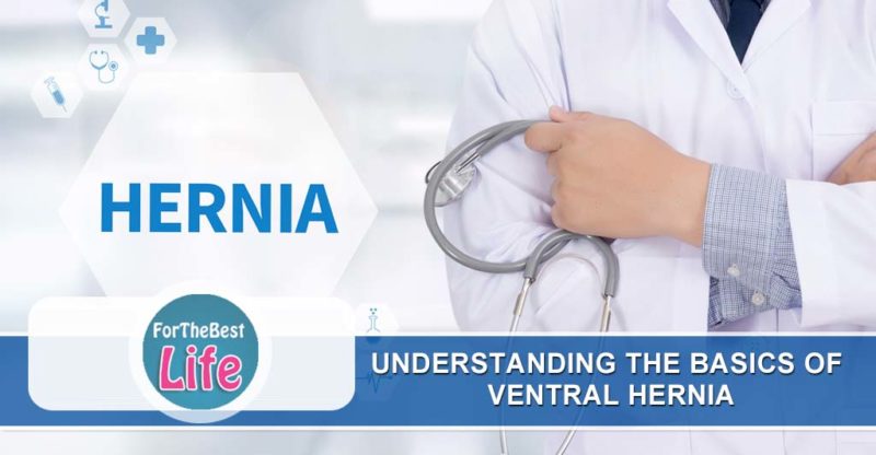 Ventral Hernia - Causes, Symptoms & Treatment