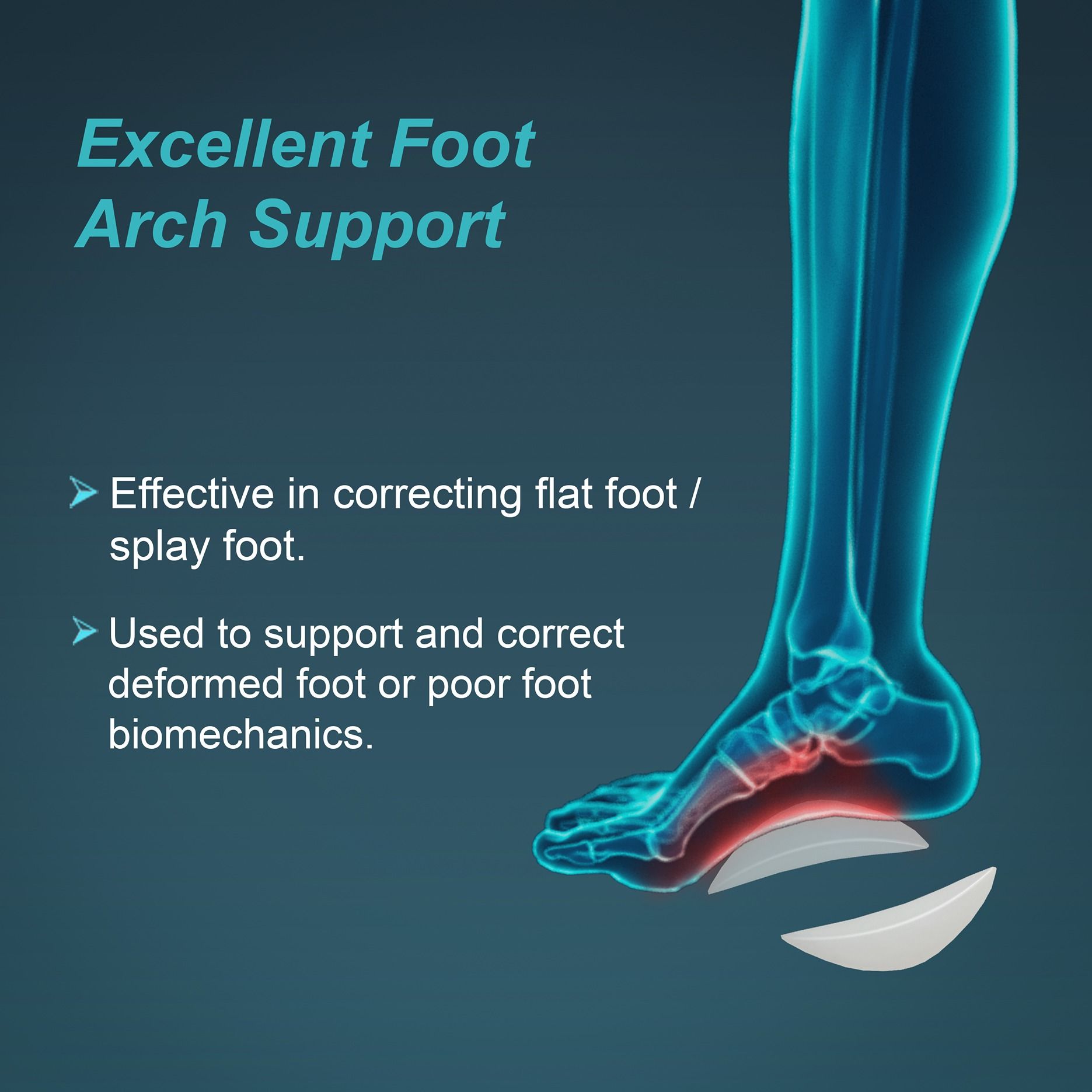 anatomical arch supports