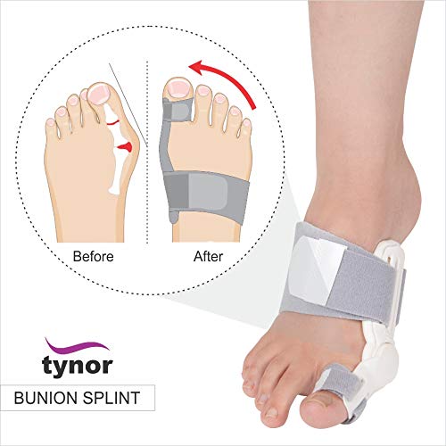 Tynor Australia Bunion Splint-4